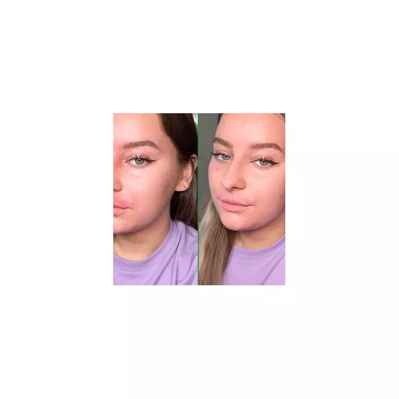 Boots Shoppers Ditch Foundation for 'Magic' £10 Concealer That Sells Out Fast