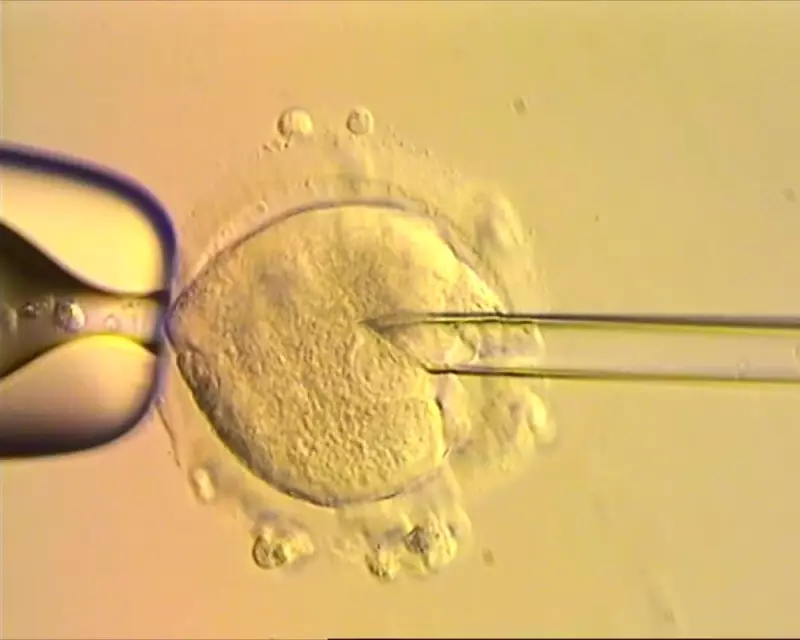 Breakthrough in IVF: Eight Healthy Babies Born Using DNA from Three People