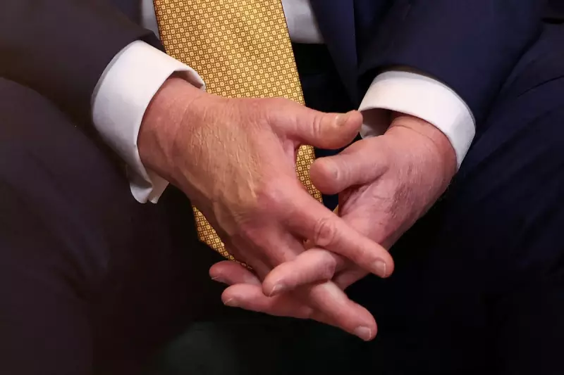 Donald Trump’s Mysterious Bruised Hand Sparks Health Speculation