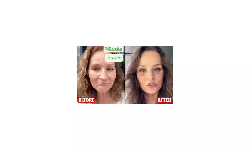 Grandmother Reveals Her Stunning 20-Year Youth Transformation After Facelift – But Has Two Major Regrets