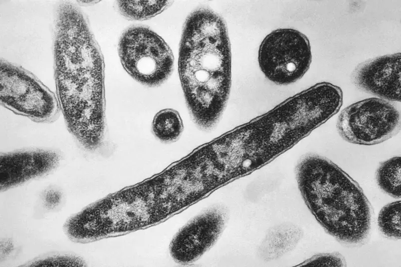 Legionnaires' Disease Outbreak in New York: One Dead and Multiple Hospitalised