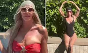 Brandi Glanville Drops Bombshell Update on Facial Disfigurement Amid Wild Night Out