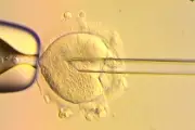 Breakthrough in IVF: World's First Babies Born Using Three-Person DNA Technique