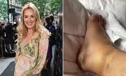 Coronation Street Star Claire Sweeney Suffers Painful Ankle Injury During Performance
