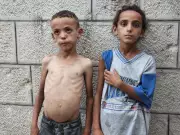 Gaza's Children Starve: 'We Faced Hunger Before, But Never Like This'