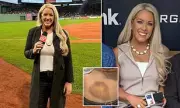 Glamorous TV Reporter Suffers Shocking Injuries After Being Hit by Foul Ball at MLB Game