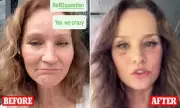Grandmother Reveals Her Stunning 20-Year Youth Transformation After Facelift – But Has Two Major Regrets