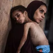 Heartbreaking Scenes in Gaza: Children on the Brink of Starvation Amid Ongoing Conflict