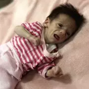 Heartbreaking Scenes in Gaza: Starving Children Struggle to Survive Amid Conflict