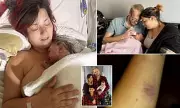 Heroic Mother Saves Her Own Life After Near-Fatal Sepsis During Childbirth – With a Kiss