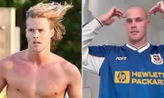 Jett Kenny, 31, Opens Up About Hair Loss and Considering a Turkish Hair Transplant