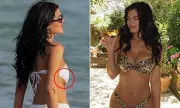 Kylie Jenner's Boob Job Secrets Revealed: Plastic Surgeon Exposes the Truth About Scarring