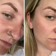 L'Oréal's New Eye Bag Remover: The £30 Miracle Cream That's Taking the UK by Storm