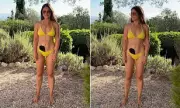 Louise Thompson Flaunts Stoma Bag in Bold Yellow Bikini, Urges Kindness Amid Public Stares