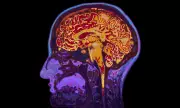 New 'Slip, Slop, Slap' Campaign Targets Brain Health to Combat Dementia