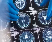 Optimists' Brains Light Up Similarly When Imagining the Future, Scans Reveal