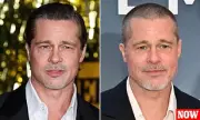 Plastic Surgeon Spills the Truth: Did Brad Pitt Really Have a Facelift?