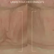 Revolutionary Anti-Wrinkle Neck Serum Stick Takes the UK by Storm – Get Youthful Skin in Seconds!