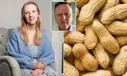 Revolutionary Food Allergy Trial Offers Hope for Sufferers: Can Eating Small Doses Cure Severe Reactions?