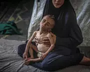 Severe Child Malnutrition in Gaza Triples in Just Two Weeks, Warns MSF