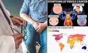 Shocking Rise in Penile Cancer Cases Among British Men: What You Need to Know