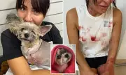 Sydney Woman Left Bloodied After Vicious Dog Attack in Mortdale – Shocking Details Revealed