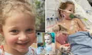 Toddler's Terrifying Ordeal: Swallowing Magnets Sparks Emergency Surgery in Queensland