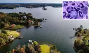 Tragedy in South Carolina: Child Dies from Rare Brain-Eating Amoeba After Lake Swim