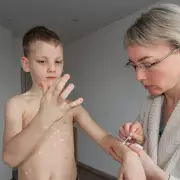 UK Measles Outbreak: Hotspots Revealed as Cases Surge – Is Your Area Affected?