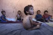 UN Warns of Catastrophic Malnutrition Crisis Among Gaza's Children