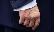 White House Addresses Concerns Over Trump's Swollen Hands and Legs