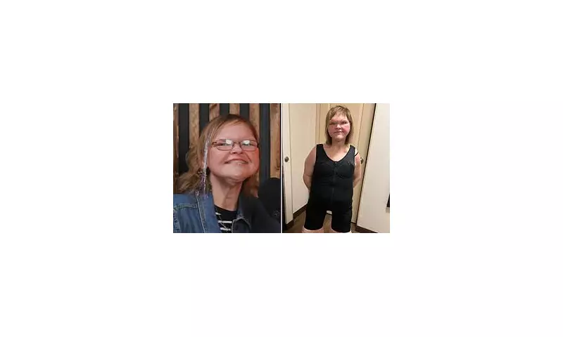 1000-lb Sisters Star Tammy Slaton Unveils Stunning Weight Loss Transformation and New Smile | Exclusive Before and After