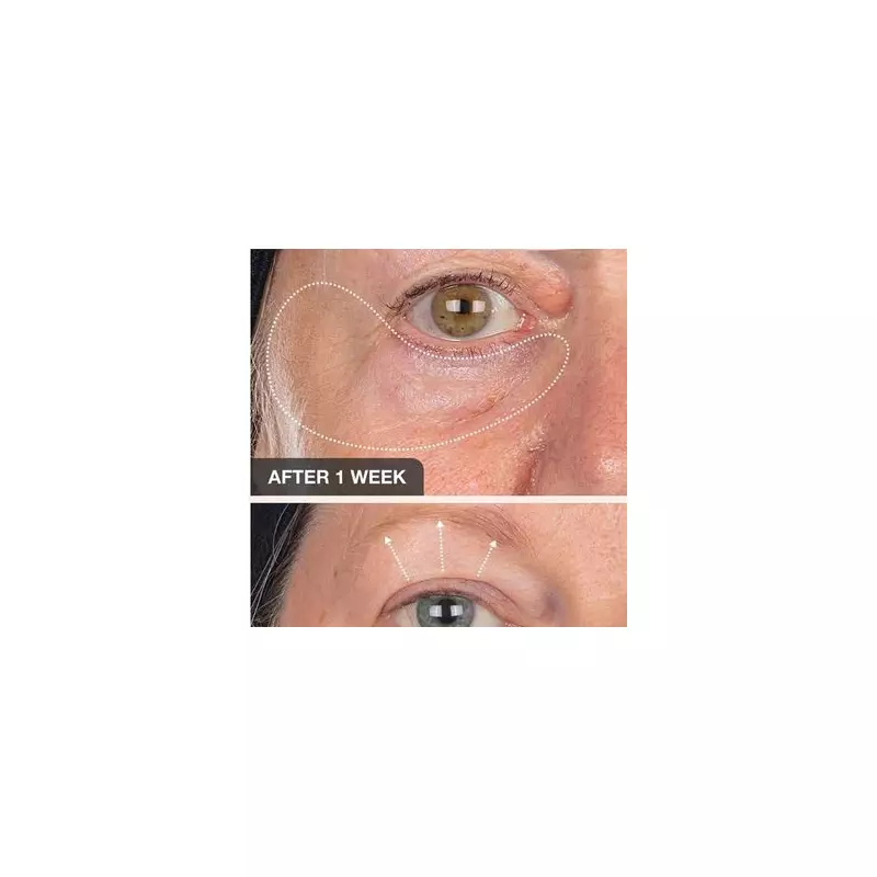Best Anti-Ageing Eye Creams to Banish Wrinkles and Dark Circles in 2024