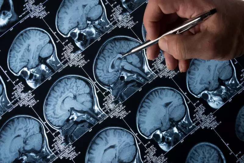 Breakthrough in Alzheimer's Research: How Cats Could Hold the Key to a Cure
