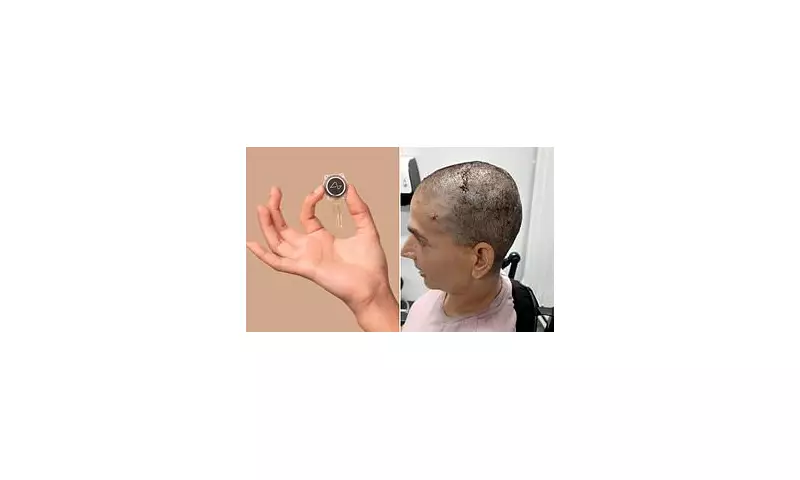 Elon Musk's Neuralink to Launch Brain Chip Trials in the UK: What You Need to Know