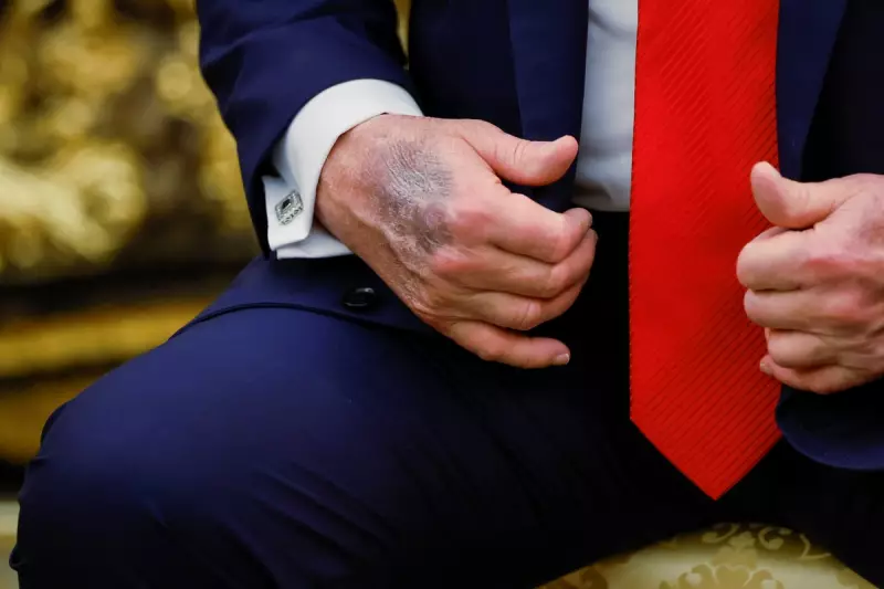 Gavin Newsom's Mysterious Hand Injury Fuels Speculation After Trump Debate | The Independent