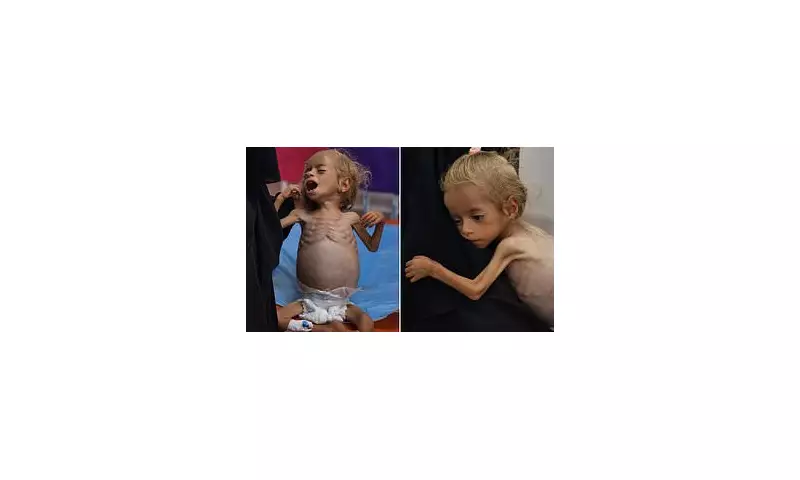 Heartbreaking Images Show Starving Gaza Boy in Tears as Malnutrition Crisis Deepens