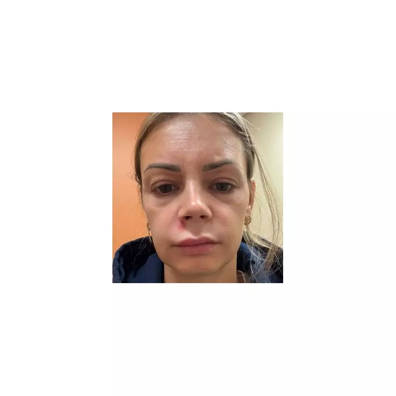 Mum Rushed to Hospital After Losing Ability to Smile – Shocking Bell's Palsy Diagnosis