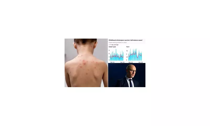 NHS Rolls Out Lifesaving Chickenpox Vaccine For All Children: What Parents Must Know
