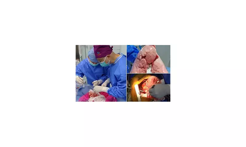 Pioneering UK Surgeons Successfully Transplant Genetically Modified Pig Lung into Human Recipient in World-First Operation