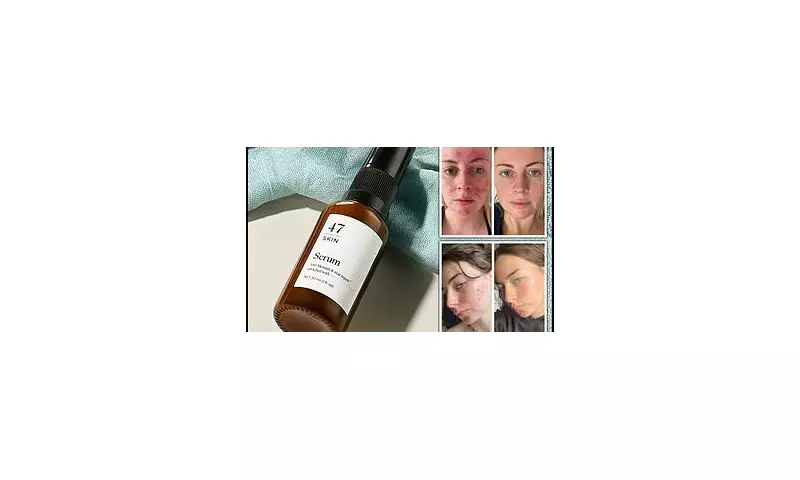 Revolutionary 47 Skin Anti-Blemish & Scar Repair Serum: The Secret to Flawless Skin?