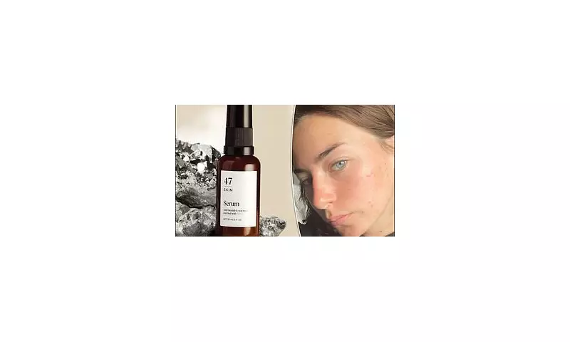 Revolutionary Silver-Infused Skincare: Can Chitoderm Banish Acne for Good?