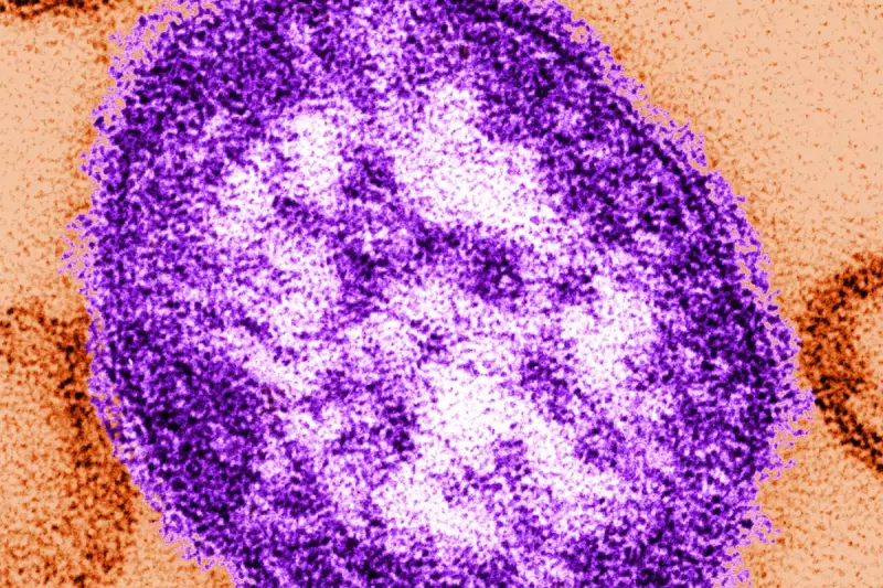 Urgent UK Measles Alert: Cases Soar by 3,000% as Health Chiefs Declare 'National Incident'