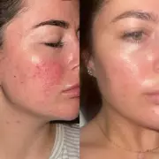 47p Skincare Dupe That Rivals £200 Creams – The Budget Beauty Secret You Need!