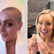 Amy Dowden's Secret Hair Growth Serum Revealed After Devastating Cancer Treatment