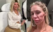 Brandi Glanville Unveils Dramatic New Look After Spending £100K on Corrective Surgery