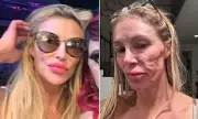 Brandi Glanville's Financial Struggles Amid Parasitic Infection Battle: 'I'm Going Broke'