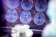 Breakthrough Study: Omega-3 Could Shield Your Brain From Alzheimer's Devastating Effects