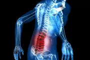Breakthrough Study: Psychotherapy Could Ease Chronic Back Pain Without Medication