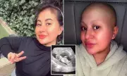 Breakthrough Study: Severe Morning Sickness in Pregnancy Linked to Higher Cancer Risk